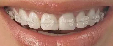 1474509691571257.jpg JDK_06.jpg