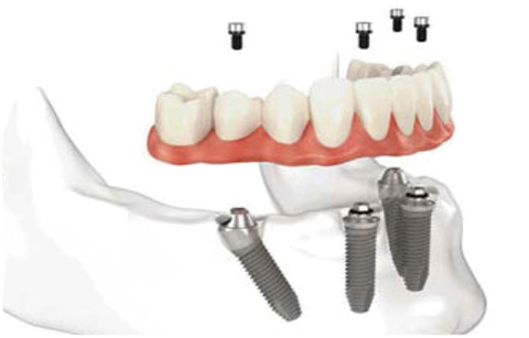 1482130804368054.jpg 331.jpg