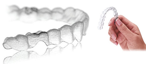 隐形牙套 隐形牙套