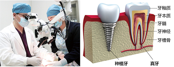 美奥口腔种植牙图片 美奥口腔种植牙图片