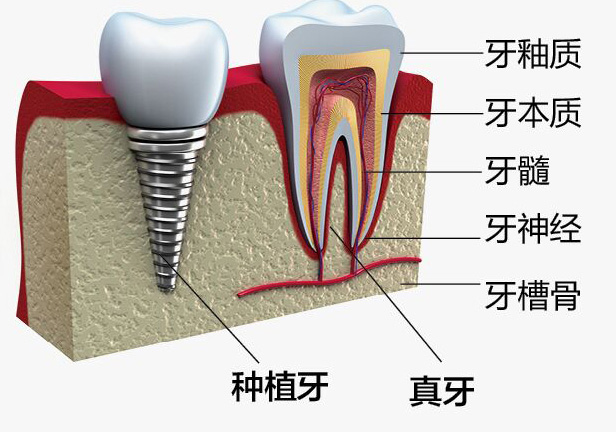 1494495005326482.jpg 333.jpg